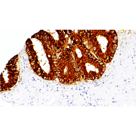 Immunohistochemistry - Anti-MUC2 Antibody [IHC122] (A324598) - Antibodies.com