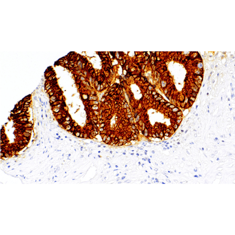 Immunohistochemistry - Anti-MUC2 Antibody [IHC122] (A324598) - Antibodies.com