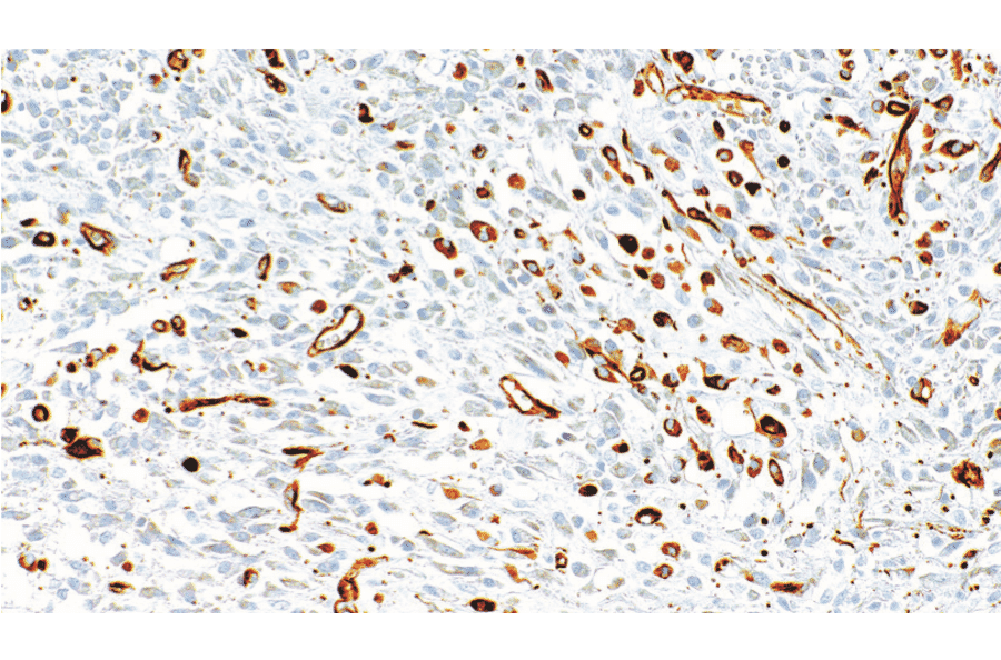 Immunohistochemistry - Anti-Nestin Antibody [IHC105] (A324601) - Antibodies.com