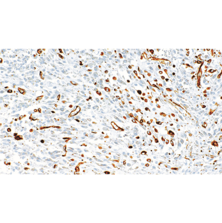 Immunohistochemistry - Anti-Nestin Antibody [IHC105] (A324601) - Antibodies.com