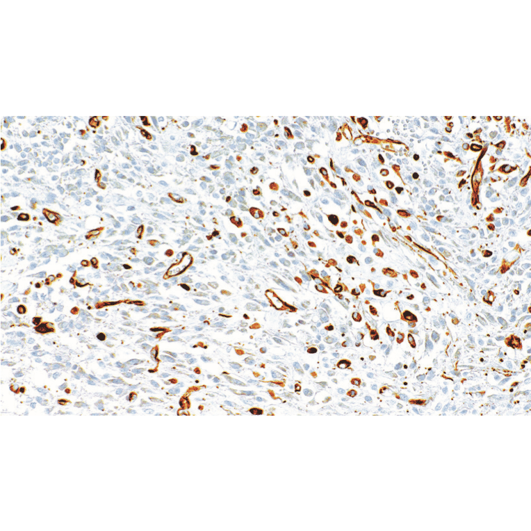 Immunohistochemistry - Anti-Nestin Antibody [IHC105] (A324601) - Antibodies.com