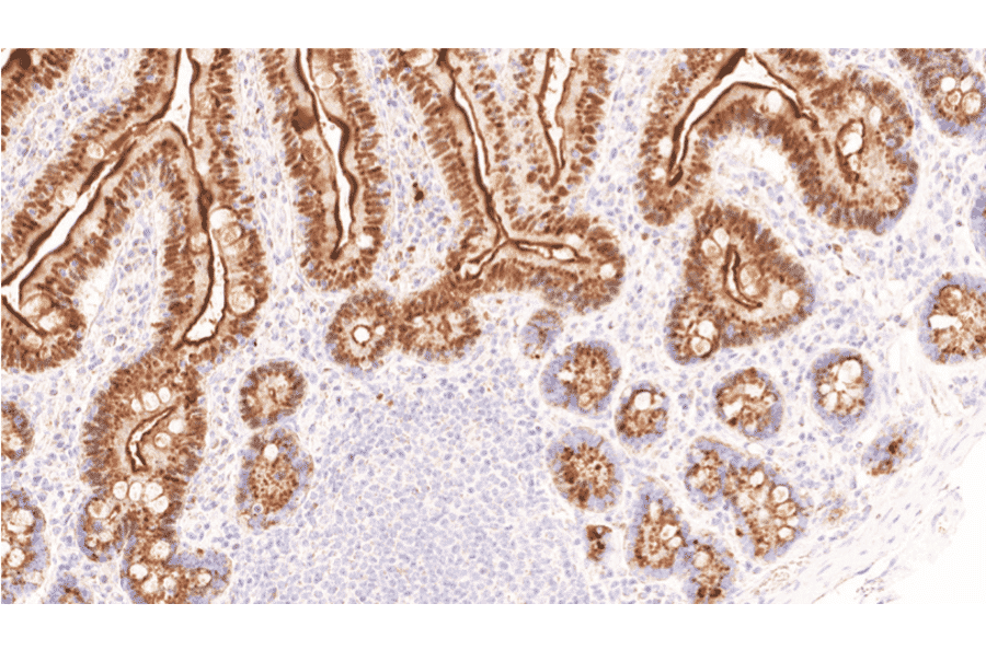 Immunohistochemistry - Anti-p21 Antibody [IHC021] (A324604) - Antibodies.com