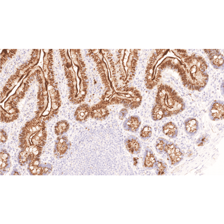 Immunohistochemistry - Anti-p21 Antibody [IHC021] (A324604) - Antibodies.com