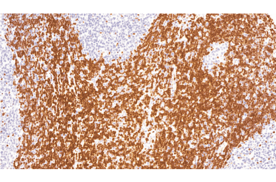 Immunohistochemistry - Anti-p27 KIP 1 Antibody [IHC128] (A324605) - Antibodies.com