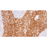 Immunohistochemistry - Anti-p27 KIP 1 Antibody [IHC128] (A324605) - Antibodies.com