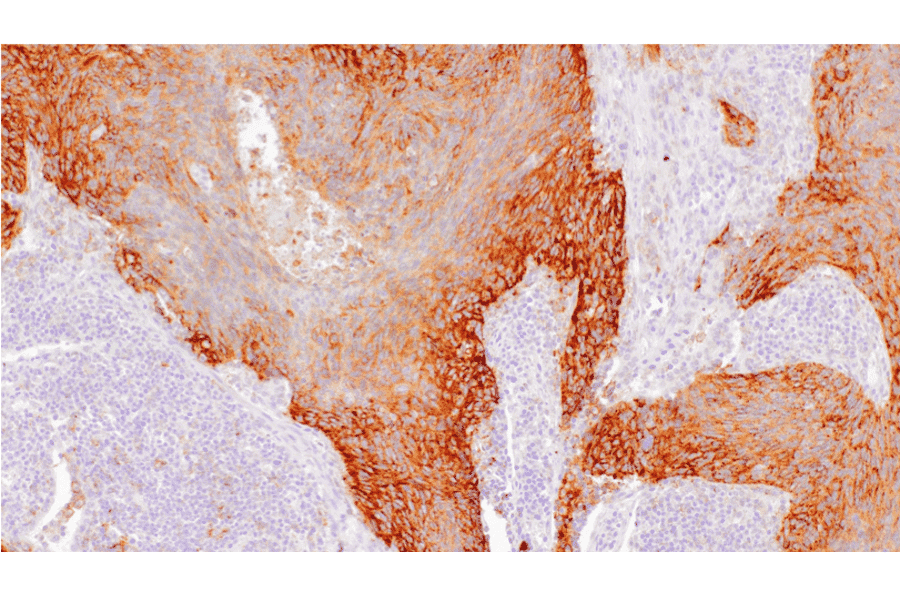 Immunohistochemistry - Anti-PD-L1 Antibody [IHC451] (A324607) - Antibodies.com