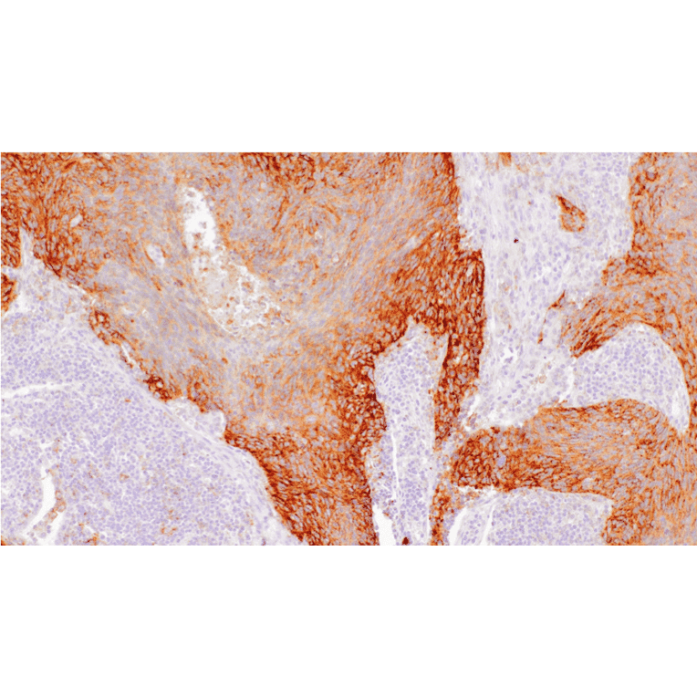 Immunohistochemistry - Anti-PD-L1 Antibody [IHC451] (A324607) - Antibodies.com