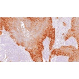 Immunohistochemistry - Anti-PD-L1 Antibody [IHC451] (A324607) - Antibodies.com