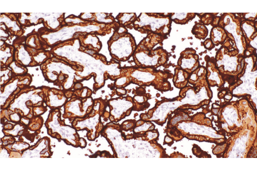 Immunohistochemistry - Anti-Placental Alkaline Phosphatase/PLAP Antibody [IHC088] (A324608) - Antibodies.com