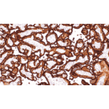 Immunohistochemistry - Anti-Placental Alkaline Phosphatase/PLAP Antibody [IHC088] (A324608) - Antibodies.com