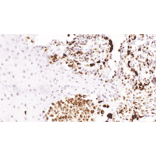 Immunohistochemistry - Anti-PRAME Antibody [IHC092] (A324609) - Antibodies.com