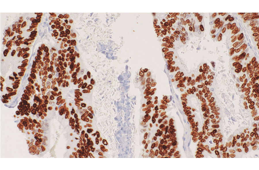 Immunohistochemistry - Anti-SATB2 Antibody [IHC095] (A324610) - Antibodies.com