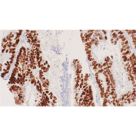 Immunohistochemistry - Anti-SATB2 Antibody [IHC095] (A324610) - Antibodies.com