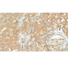 Immunohistochemistry - Anti-SIGLEC15 Antibody [IHC096] (A324611) - Antibodies.com