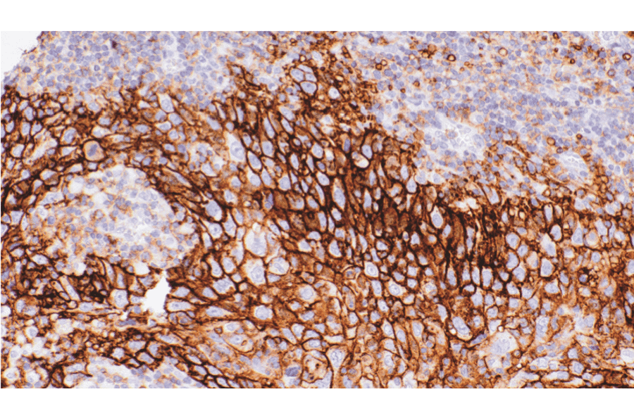 Immunohistochemistry - Anti-SLC16A3/MCT 4 Antibody [IHC124] (A324612) - Antibodies.com