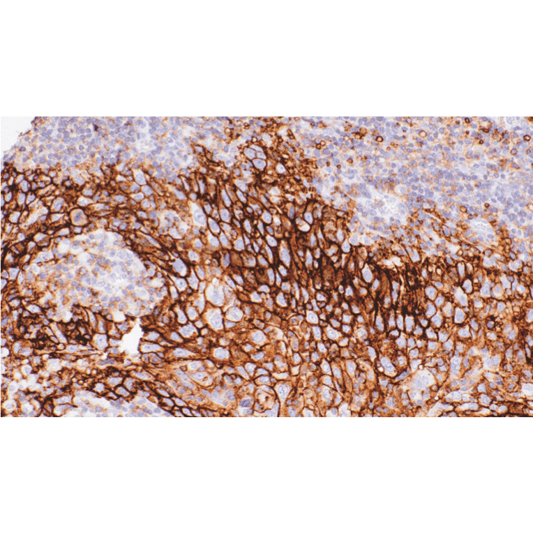 Immunohistochemistry - Anti-SLC16A3/MCT 4 Antibody [IHC124] (A324612) - Antibodies.com