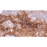Immunohistochemistry - Anti-SLC16A3/MCT 4 Antibody [IHC124] (A324612) - Antibodies.com