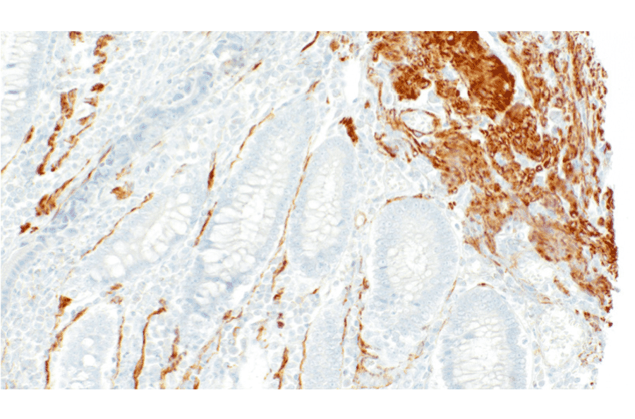 Immunohistochemistry - Anti-Smooth Muscle Myosin Antibody [IHC091] (A324613) - Antibodies.com