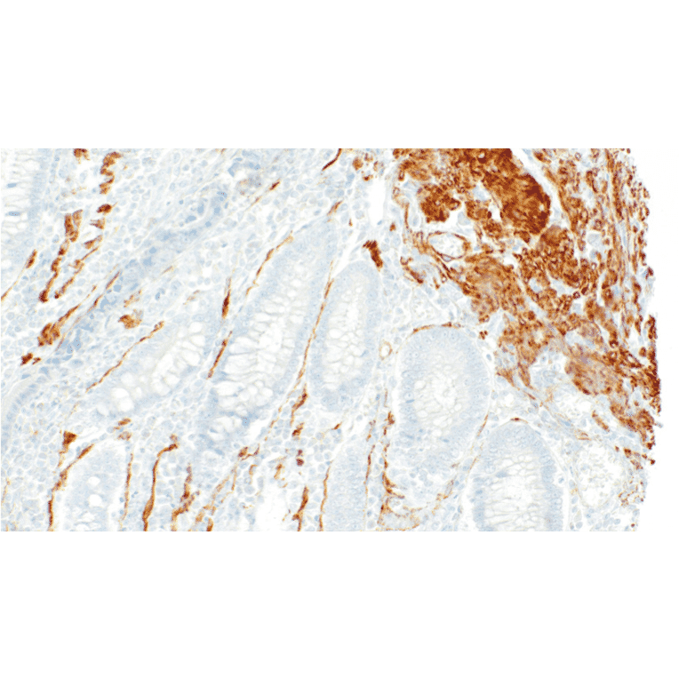 Immunohistochemistry - Anti-Smooth Muscle Myosin Antibody [IHC091] (A324613) - Antibodies.com