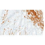 Immunohistochemistry - Anti-Smooth Muscle Myosin Antibody [IHC091] (A324613) - Antibodies.com