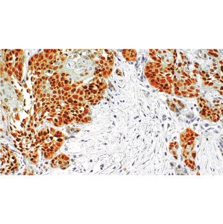 Immunohistochemistry - Anti-SOX2 Antibody [IHC129] (A324614) - Antibodies.com