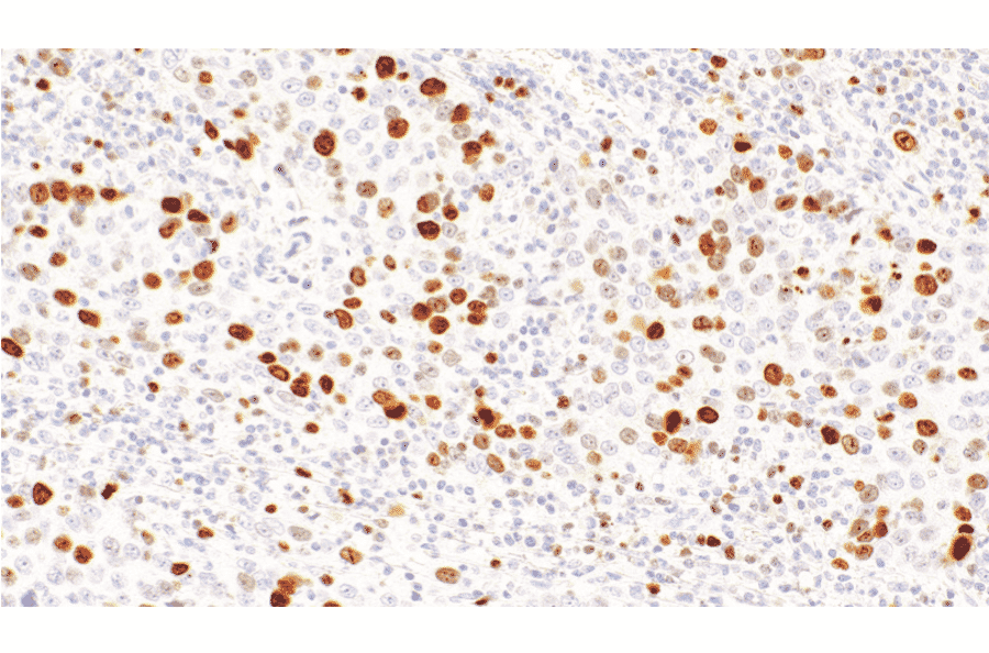 Immunohistochemistry - Anti-Topoisomerase II alpha Antibody [IHC112] (A324615) - Antibodies.com