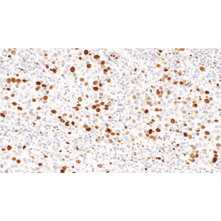 Immunohistochemistry - Anti-Topoisomerase II alpha Antibody [IHC112] (A324615) - Antibodies.com
