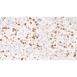 Immunohistochemistry - Anti-Topoisomerase II alpha Antibody [IHC112] (A324615) - Antibodies.com