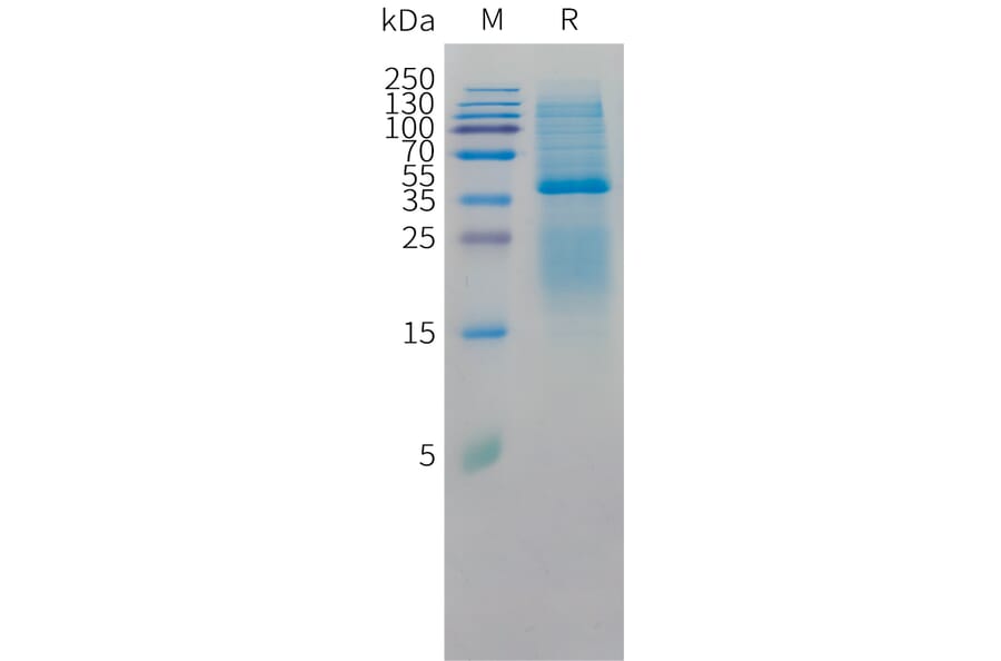 SDS-PAGE - Recombinant Cynomolgus macaque CD3D Protein (10xHis Tag) + CD3 epsilon Protein (Fc Tag) (A324669) - Antibodies.com
