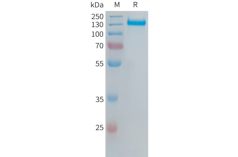 SDS-PAGE - Recombinant Human Integrin alpha V Protein (6xHis Tag) + ITGB6 Protein (Fc Tag) (A324671) - Antibodies.com