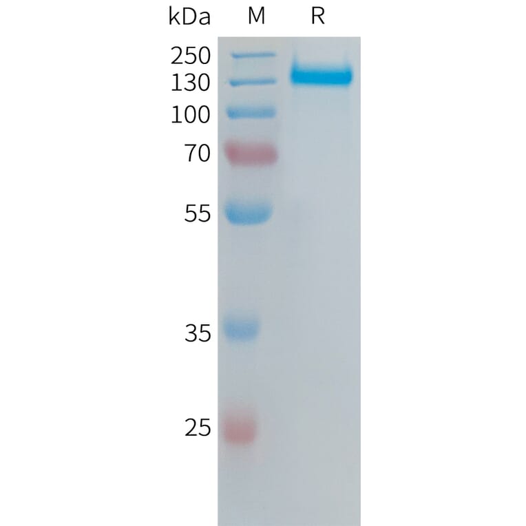 SDS-PAGE - Recombinant Human Integrin alpha V Protein (6xHis Tag) + ITGB6 Protein (Fc Tag) (A324671) - Antibodies.com