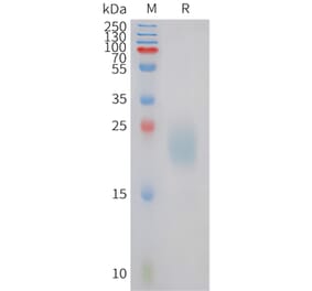 SDS-PAGE - Recombinant Canine IL31 Protein (6xHis Tag) (A324696) - Antibodies.com
