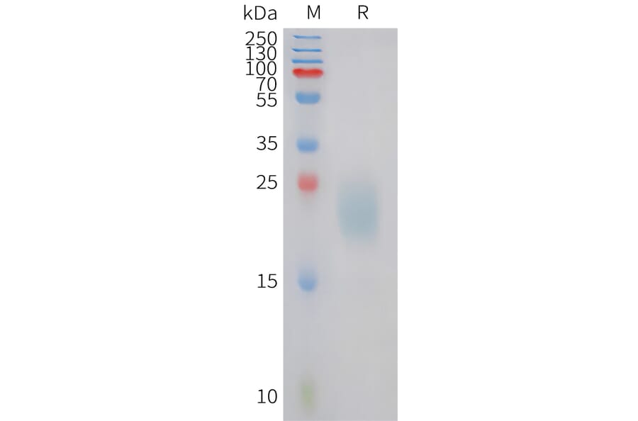 SDS-PAGE - Recombinant Canine IL31 Protein (6xHis Tag) (A324696) - Antibodies.com