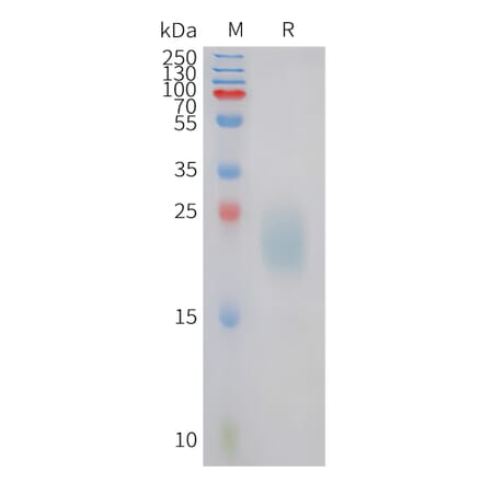 SDS-PAGE - Recombinant Canine IL31 Protein (6xHis Tag) (A324696) - Antibodies.com