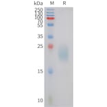 SDS-PAGE - Recombinant Canine IL31 Protein (6xHis Tag) (A324696) - Antibodies.com