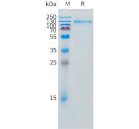 SDS-PAGE - Recombinant Canine IL31RA Protein (Fc Tag) (A324697) - Antibodies.com