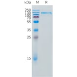SDS-PAGE - Recombinant Canine IL31RA Protein (Fc Tag) (A324697) - Antibodies.com