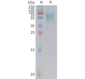 SDS-PAGE - Recombinant Cynomolgus macaque 5T4 Protein (10xHis Tag) (A324701) - Antibodies.com