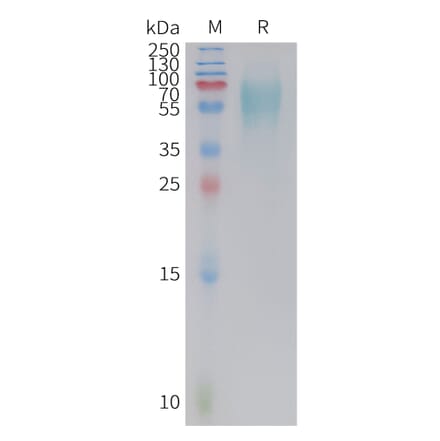 SDS-PAGE - Recombinant Cynomolgus macaque 5T4 Protein (10xHis Tag) (A324701) - Antibodies.com