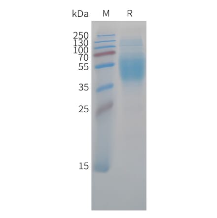 SDS-PAGE - Recombinant Cynomolgus macaque B7-H4 Protein (10xHis Tag) (A324702) - Antibodies.com