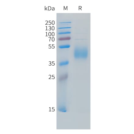 SDS-PAGE - Recombinant Cynomolgus macaque B7-H6 Protein (10xHis Tag) (A324703) - Antibodies.com