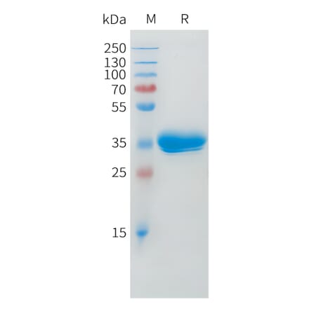 SDS-PAGE - Recombinant Cynomolgus macaque BCMA Protein (Fc Tag) (A324704) - Antibodies.com
