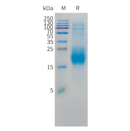 SDS-PAGE - Recombinant Cynomolgus macaque CD3D Protein (10xHis Tag) (A324706) - Antibodies.com