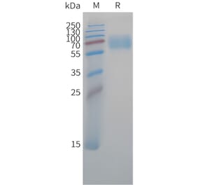 SDS-PAGE - Recombinant Cynomolgus macaque CD47 Protein (Fc Tag) (A324707) - Antibodies.com