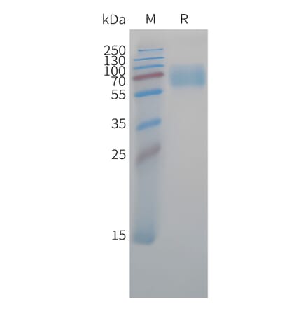 SDS-PAGE - Recombinant Cynomolgus macaque CD47 Protein (Fc Tag) (A324707) - Antibodies.com
