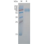 SDS-PAGE - Recombinant Cynomolgus macaque CD47 Protein (Fc Tag) (A324707) - Antibodies.com