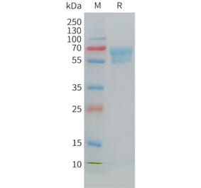 SDS-PAGE - Recombinant Cynomolgus macaque CD7 Protein (Fc Tag) (A324708) - Antibodies.com