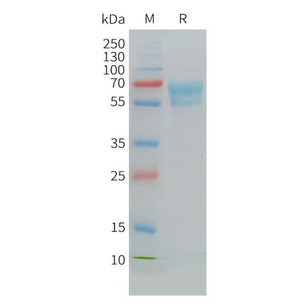 SDS-PAGE - Recombinant Cynomolgus macaque CD7 Protein (Fc Tag) (A324708) - Antibodies.com
