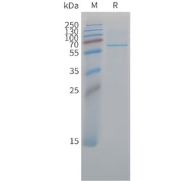 SDS-PAGE - Recombinant Cynomolgus macaque CD73 Protein (10xHis Tag) (A324709) - Antibodies.com