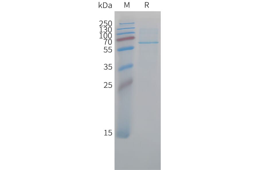 SDS-PAGE - Recombinant Cynomolgus macaque CD73 Protein (10xHis Tag) (A324709) - Antibodies.com